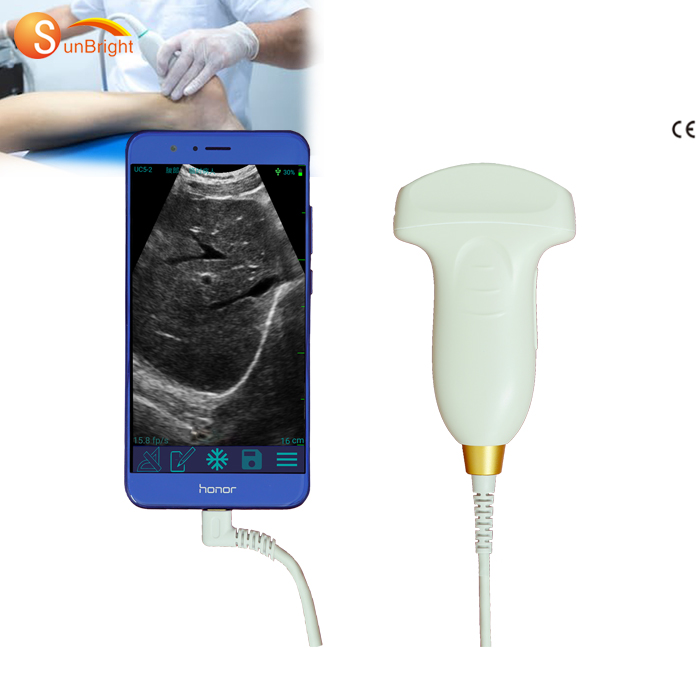 CE 128 elements Portable USB ultrasound scanner convex transducer probe for software for Windows 8 Or 10