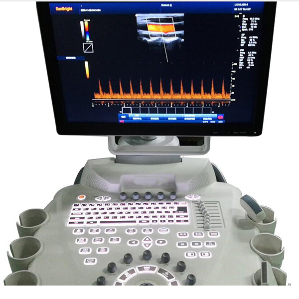 probe trolley color Doppler ultrasound6
